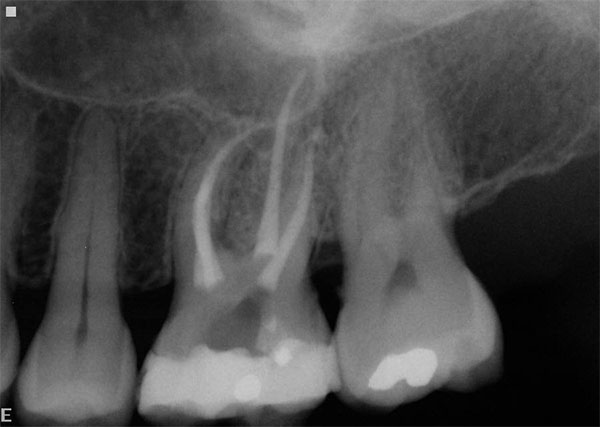 dental radiography saanich